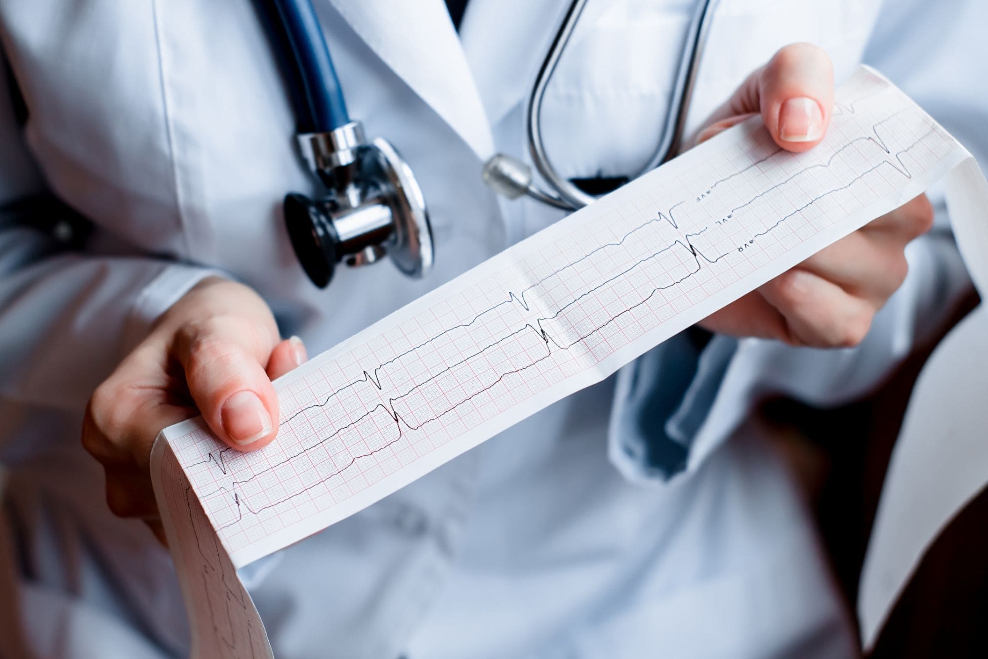A person in a white lab coat with a stethoscope around their neck holds a paper printout of an electrocardiogram (ECG or EKG) showing heart activity.
